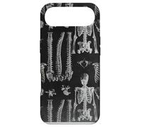 Custodia per iPhone Air Design ortopedico a tema anatomico scheletrico della spina dorsale