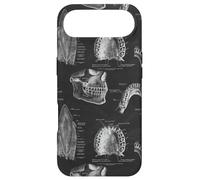 Custodia per iPhone Air Tema Dentale Vintage Denti Umani Anatomia Grafica