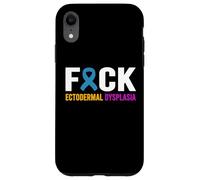 Custodia per iPhone XR Fuck Ectodermal Dysplasia - Ectodermal Dysplasia Awareness