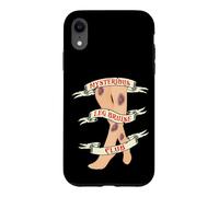 Custodia per iPhone XR Mysterious Leg Bruise Club - Funny Clumsy Person
