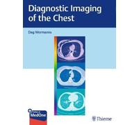 Dag Wormanns Diagnostic Imaging of the Chest (Mixed Media Product)