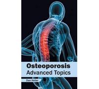 Dan Heller Osteoporosis: Advanced Topics (Copertina rigida)