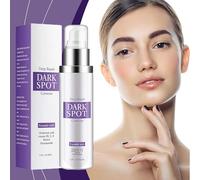 Dark Spot Remover for Face, Dark Spot Corrector Glow Serum, Skin Brown Spot Remover, Sun Spot Remover, Age Spot Corrector, Rapid Tone Repair Retinol, Skin Care Face Body Cream 50g (1)