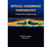 Darrin A Landry Optical Coherence Tomography a Clinical Atlas of Ret (Tascabile)