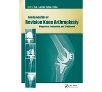 David Jacofsky Anthony Fundamentals of Revision Knee Arthro (Copertina rigida)