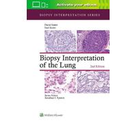 David Suster Saul Suster Biopsy Interpretation of the Lung (Copertina rigida)