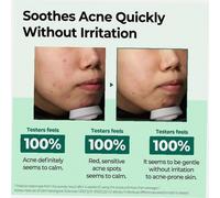 Day Cream Some By Mi Aha.Bha.Pha 60G 30 Days Miracle Cream (Day Cream) Unisex