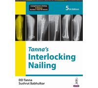 DD Tanna Sushrut Babhulkar Tanna’s Interlocking Nailing (Tascabile)