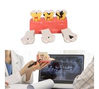 DECAY MODEL MODELLO DEGLI DEMBRICAZIONE MODELLO DEGLI DOE CARIE PER L'Educazione