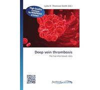 Deep vein thrombosis: The harmful blood clots
