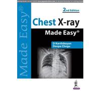Deepa Chegu D. Karthikeyan Chest X-ray Made Easy (Tascabile)