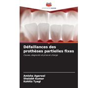 Défaillances des prothèses partielles fixes: Causes, diagnostic et prise en charge