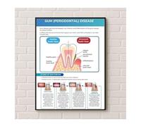 Dental Office Decor Canvas Print Gum Disease Educational Poster Human Teeth Anatomy Chart Wall Art(Unframed,12x18inch(30x45cm))