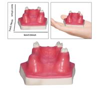 Dental Typodont Implant Dente Modello di addestramento medico per impianto