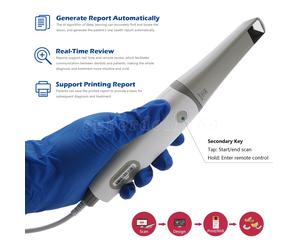 Dentale Intra oral 3D Scanner Intraoral Color&Free AI Scan Scanning Software CAD