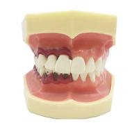 Dentale Typodont Denti Modello per Studio Parodontale, Anatomia Orale Insegnamento e Formazione Implantare, Rappresentazione Realistica di Gengive e Denti, Strumento Educativo