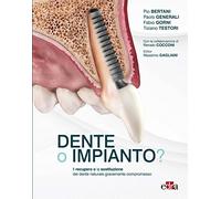 Dente o impianto? Il recupero o la sostituzione del dente naturale gravemente compromesso