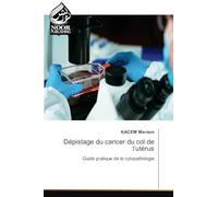 Dépistage du cancer du col de l'utérus