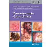 Dermatoscopia : casos clínicos