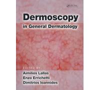 Dermoscopy in General Dermatology
