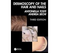 Dermoscopy of the Hair and Nails 3e