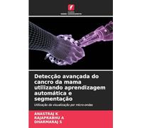 Detecção avançada do cancro da mama utilizando aprendizagem automática e segmentação: Utilização da visualização por micro-ondas