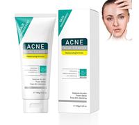 Detergente Viso Anti-Acne - Pulizia Profonda per Pori Liberi, Controlla l'Eccesso di Sebo, Riduce Brufoli e Punti Neri, Effetto Lenitivo Contro L'Acne, Cleaner Per Uomini E Donne