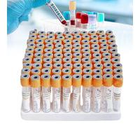DHsdlpLU Provette per Coagulazione del Sangue sotto Vuoto Senza Materiale Pet Additivo per L'uso in Centrifuga per Sangue Venoso E Compatibilità con Il Set,Yellow-5ml