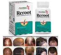 DHT Blocker Hair Growth Supplement Biotina ad alta potenza e Saw Palmetto 60 ...