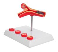 di blocco vascolare - Simulazione del di flusso sanguigno