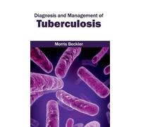 Diagnosis and Management of Tuberculosis (Copertina rigida)