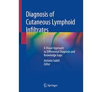 Antonio Subtil Diagnosis of Cutaneous Lymphoid Infiltrates (Tascabile)