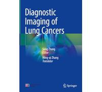 Diagnostic Imaging of Lung Cancers