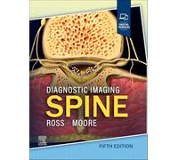 Diagnostic Imaging: Spine