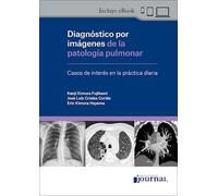 DIAGNOSTICO POR IMAGENES DE LA PATOLOGIA PULMONAR