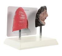 DIKACA Modello Anatomico Polmonare in Pvc Realistico Confronto Polmone Sano per Insegnamento Medico e Fisiologia Scuole Medie, Facoltà di Medicina e Scienze della Salute