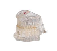 DIKACA Modello Rimovibile in per Insegnamento Odontotecnico Modello Anatomico Didattico per Studio e Pianificazione Trattamenti Dimostrazione Impianti e Pazienti