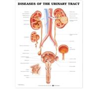 Diseases of the Urinary Tract Anatomical Chart (Poster)