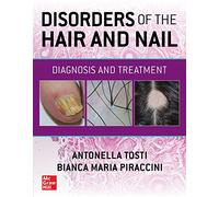 Disorders of the Hair and Nail: Diagnosis and Treatment