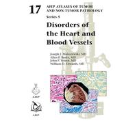 Disorders of the Heart and Blood Vessels: 17