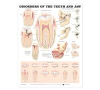 Disorders of the Teeth and Jaw Anatomical Chart