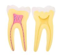 DOITOOL Modello Anatomico Molare in Pvc Giallo per Insegnamento Odontoiatrico, Leggero e Resistente, per Dimostrazioni in Corsi Dentali