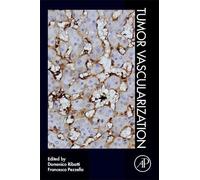 Domenico Ribatti Tumor Vascularization (Tascabile)