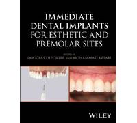 Douglas Deporte Immediate Dental Implants for Esthetic and Pr (Copertina rigida)