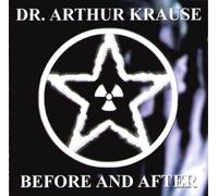 Dr. Arthur Krause - Before & After