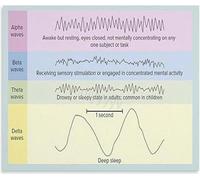 Dream Brain Poster Sleep Cycle Science | Chart showing nocturnal electrical pulses(Magnetic,12x18inch(30x45cm))