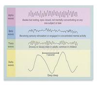 Dream Cycle Science Poster Exploring Brain Waves from Light Sleep to Deep Sleep Wall Decor(Unframed,08x12inch(20x30cm))