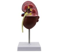 DRXRD Modello di Rene Sano e Rene Malato, Modello Anatomico Rene Umano con Identificazione Digitale della Posizione Anatomica e Diagramma della Posizione Anatomica