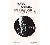 Du bleu sur les veines