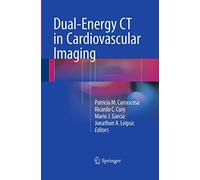 Dual-Energy CT in Cardiovascular Imaging